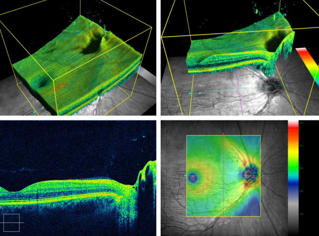 3D server OCT 3D server OCT