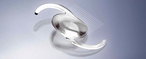 Veštačko sočivo (slika 1) Intraokularno sočivo