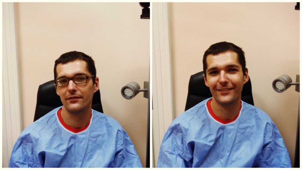 Macko Jan Danijel - iskustvo pacijenta