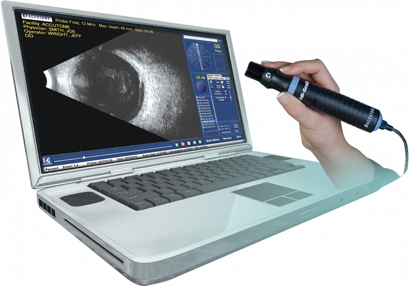 Ultrazvučna dijagnostika