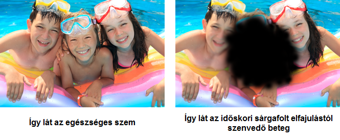 makula-degeneracio-szimulator