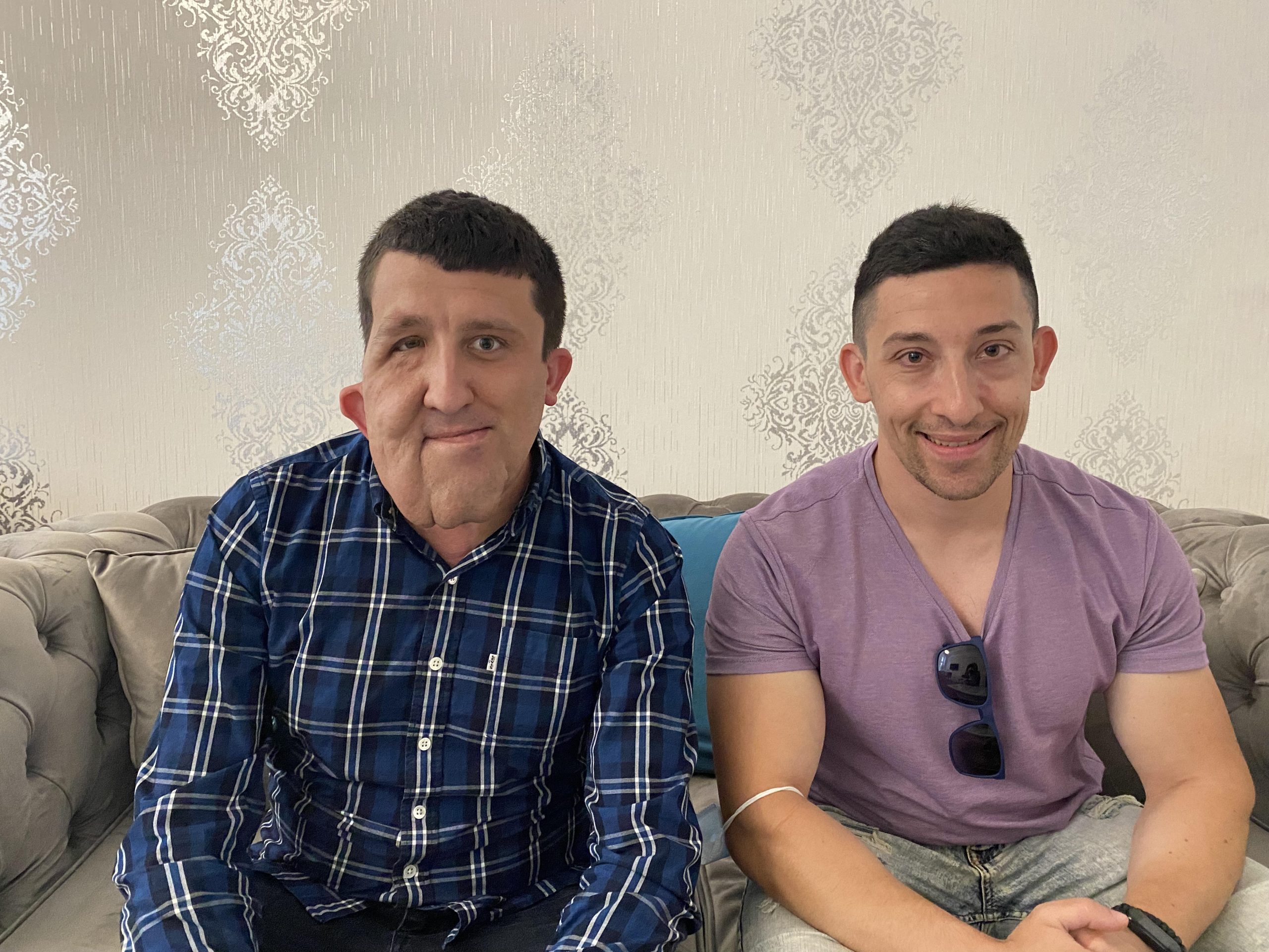 Lasersko skidanje dioptrije iskustva