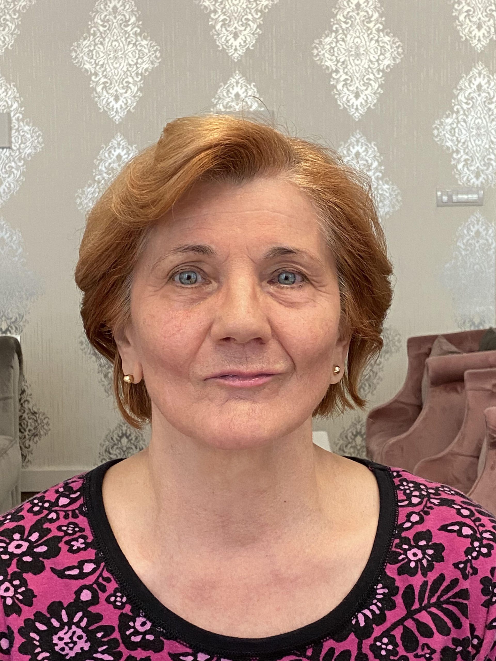 Operacija-katarakte-iskustva