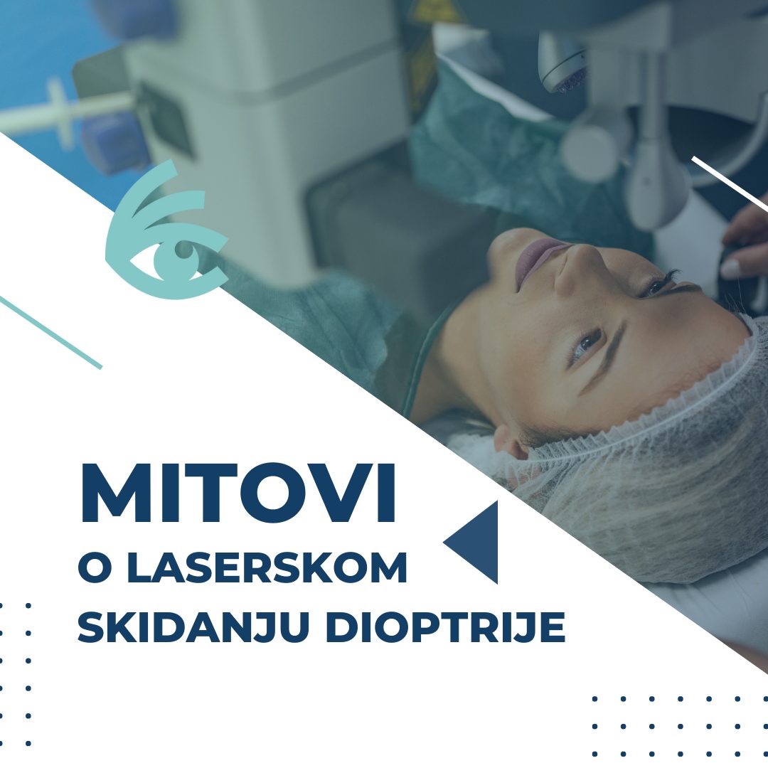 mitovi o laserskom skidanju dioptrije